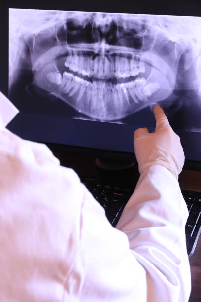 Best Emergency Dental Extractions in Greer, SC