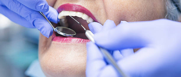 Best Emergency Root Canal Treatment in Greer, SC