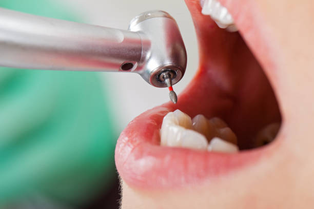 Best Pediatric Emergency Dentist in Greer, SC